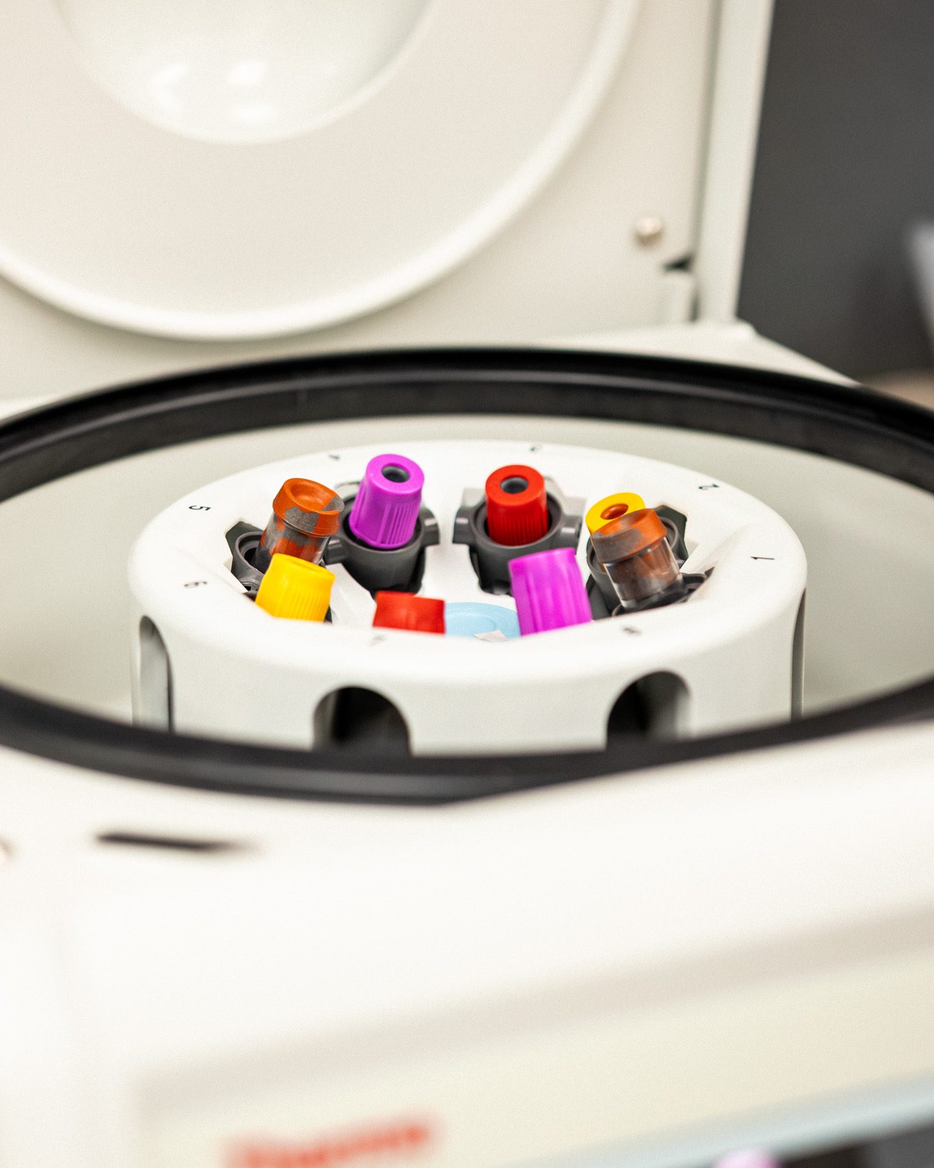 Polycystic Kidney Disease: The Research Behind the First Treatment, and Augusta's Part in It